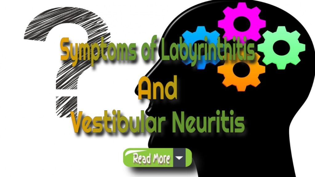 Symptoms And Onset Of Viral Neuritis Or Labyrinthitis