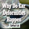 Why Do Ear Deformities Happen – Do Ears Change As You Get Older