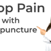 Acupuncture Tips That Will Help You Improve Your Health