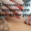 Acupuncturists: What Can They Do For You?