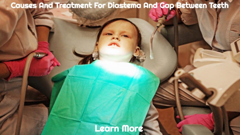 Causes And Treatment For Diastema And Gap Between Teeth