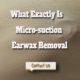 What Exactly Is Micro-suction Earwax Removal?