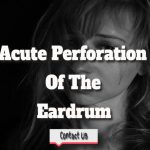 An Eardrum Has Ruptured—Acute Perforation Of The Eardrum.