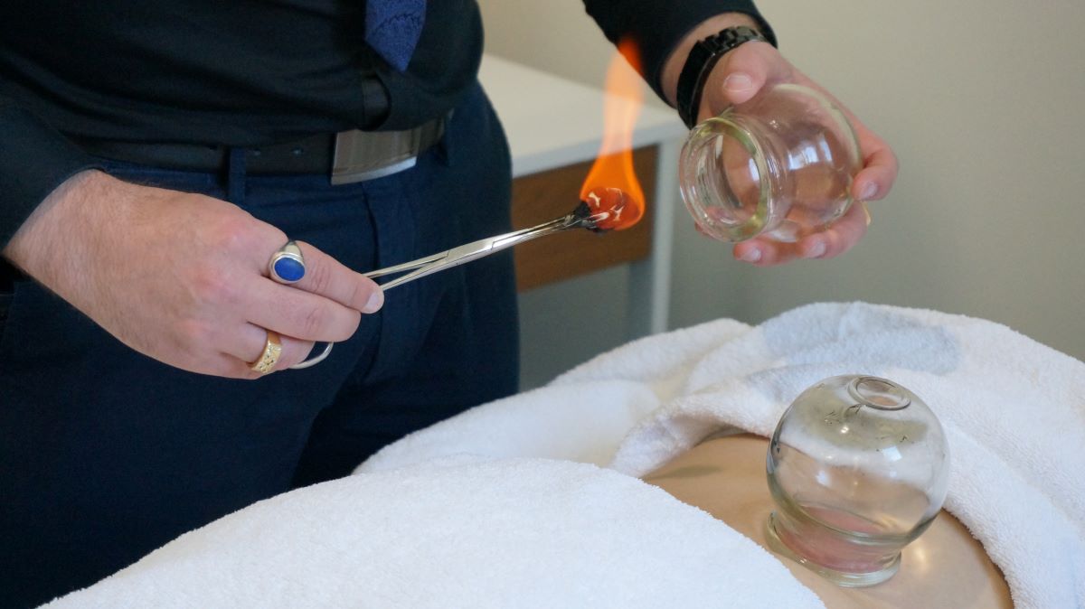 Two-step cupping therapy process: preparation and application icons